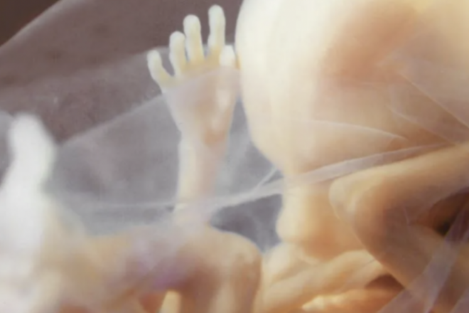 BREAKING: Arizona Supreme Court Upholds Near-Total Abortion Ban