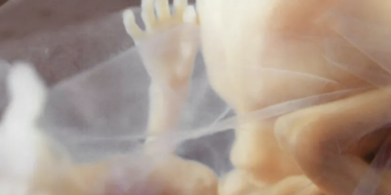 BREAKING: Arizona Supreme Court Upholds Near-Total Abortion Ban